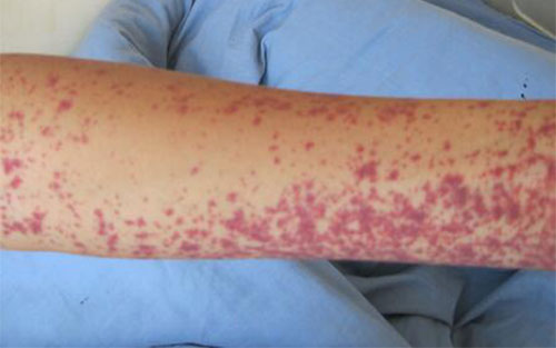 ��������񰴫Ⱦ�� ��������������